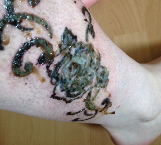 Infected Tattoos Designs, Ideas and Meaning Tattoos For You