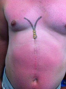 Zipper Tattoo on Chest