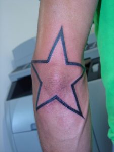 Star Tattoo on Elbow